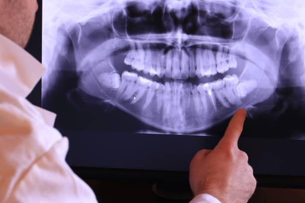 Best Emergency Dental Surgery in Tenino, WA